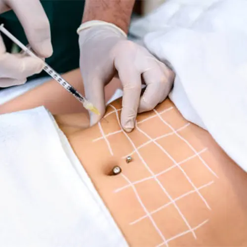 Lipolytic Injections